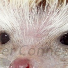 Eyes